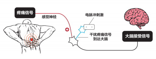 【ZE科普】一樣是電，為什么名字如此花哨
