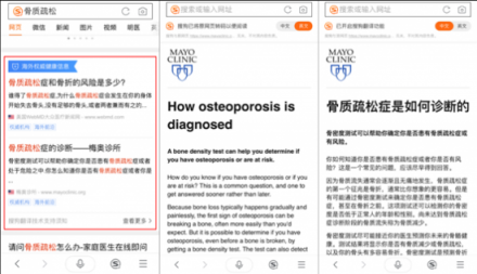 骨質(zhì)疏松你真的了解嗎？搜狗搜索教你正確守護(hù)骨骼健康