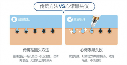 雙11最值得入手的面部清潔電器！美國心諾黑頭儀價格直降一半！