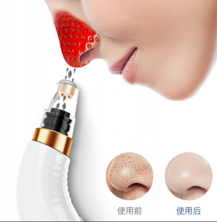 黑頭儀有用嗎？一次性讓你的黑頭全走光