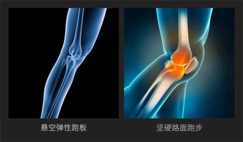 小米眾籌首款智能折疊跑步機來襲，讓愛跑步的人有“地”放矢