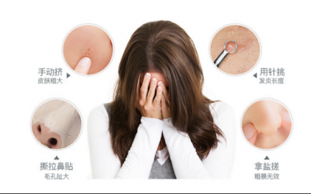 正確的清除黑頭方法來啦！黑頭儀有用嗎？
