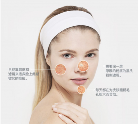 一百種去黑頭的方法都失敗了？去黑頭攻略全部拿下！