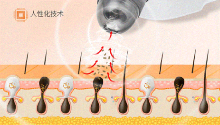 家里必備美容儀器，黑頭儀哪個(gè)牌子好？