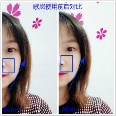 雅萌、GEVILAN歌嵐、Tripollar、NEWA美容儀到底選哪個(gè)？先評(píng)測一下再說