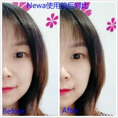 雅萌、GEVILAN歌嵐、Tripollar、NEWA美容儀到底選哪個(gè)？先評(píng)測一下再說