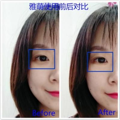 雅萌、GEVILAN歌嵐、Tripollar、NEWA美容儀到底選哪個(gè)？先評(píng)測一下再說