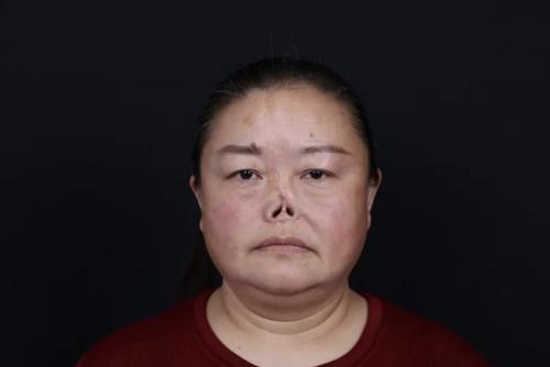 她，被羞辱欺凌40年，2020年成為新氧公益救助第一人