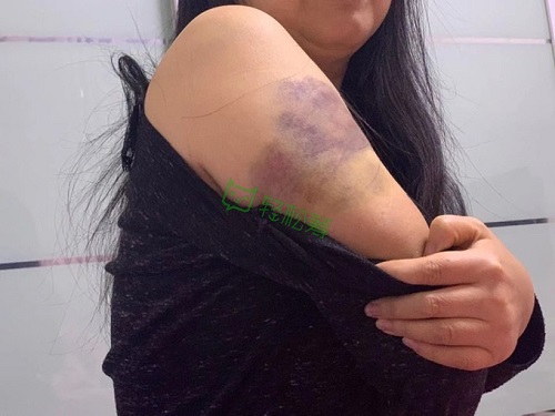 “我想有生之年看到女兒出嫁！”浙江婦女患罕見病發(fā)起輕松籌急籌19萬治療費