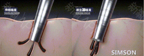 千萬主播的背后是粉絲熬夜相陪 長時間看直播會導(dǎo)致脫發(fā)？