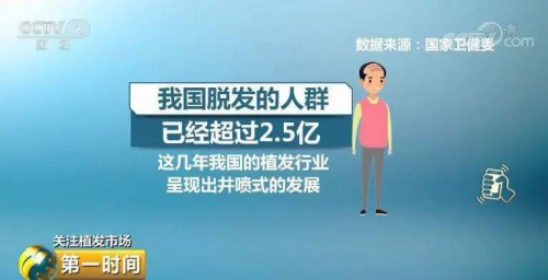 武漢新生植發(fā)：90后加入脫發(fā)大軍，3D植發(fā)技術(shù)幫助有效拯救顏值