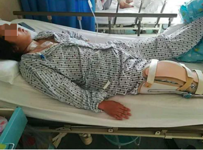 水滴籌·水滴公益助單親爸爸救骨癌女兒：我與女兒相依為命，不能沒有她