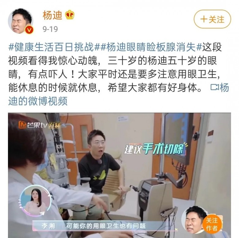 楊迪瞼板腺消失上熱搜，你的眼睛護(hù)理還敢耽誤嗎？