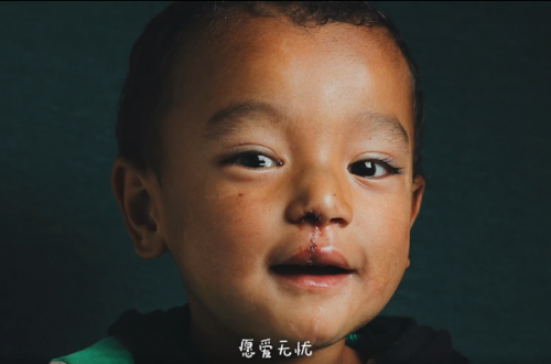 輕松集團(tuán)、輕松公益助力嫣然天使西藏行 為唇腭裂患兒再謀福利