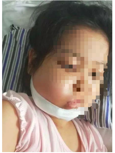 女童3歲確診白血病7歲復發(fā)，百萬治療費無著落，水滴籌款幫孩子圓上學夢