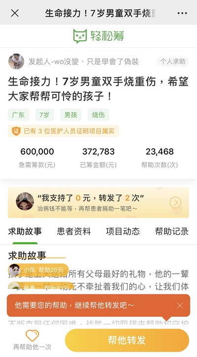 生命接力！輕松籌上愛心匯聚，幫助被生父燒傷的可憐男童重獲新生