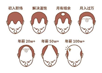 2.5億人被脫發(fā)困擾？Rogaine培健實力生發(fā)