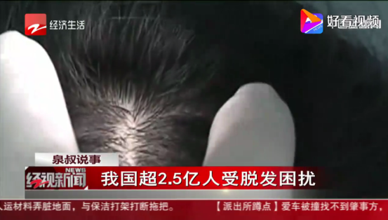 福州新生植發(fā)：超2.5億人受脫發(fā)困擾，年輕化趨勢(shì)嚴(yán)峻