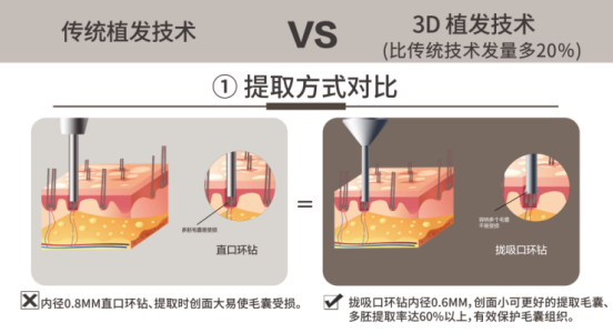 廈門新生植發(fā)：脫發(fā)人數(shù)超2.5億，雙十二消費報告植發(fā)數(shù)據(jù)爆增