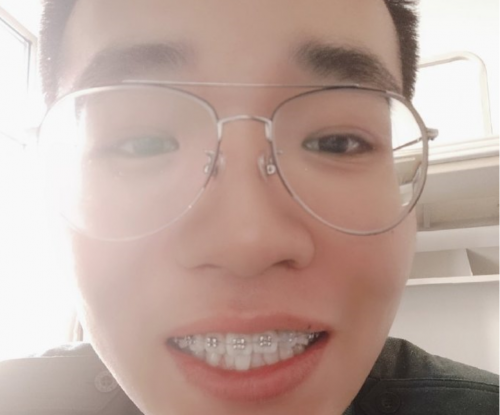 警惕！別讓歪牙阻礙大好青春