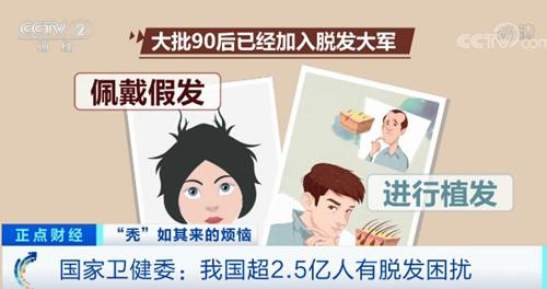 杭州新生植發(fā)：大批90后脫發(fā)，多數(shù)人進(jìn)行3D植發(fā)