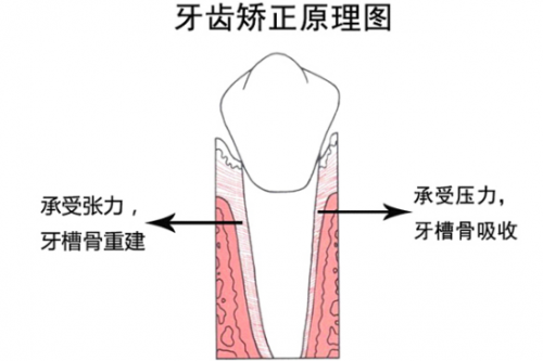 3D數(shù)字化模型矯牙“神器”，讓你不懼年齡“矯”傲逆襲
