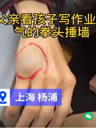 虎爸輔導(dǎo)孩子作業(yè)致使自己受傷，不妨試試訊飛智能學(xué)習(xí)機(jī)