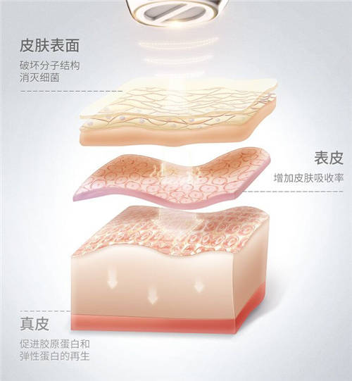 COSBEAUTY可思美專注研發(fā)，新品等離子凈膚儀憑實(shí)力圈粉