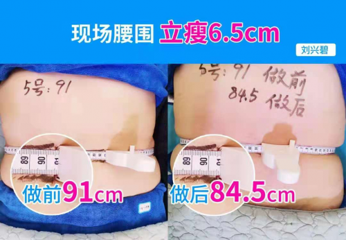 破6.7億！秀域“夏日捉腰季”抖音活動席卷多地，智能纖體項目有口皆碑