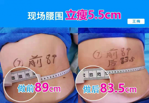 破6.7億！秀域“夏日捉腰季”抖音活動席卷多地，智能纖體項目有口皆碑