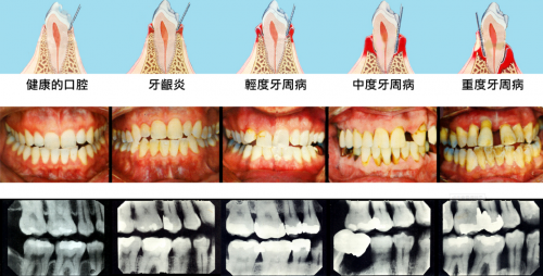 8月5日小米有品眾籌！素諾智能可視沖牙器C3 pro倒計(jì)時(shí)海報(bào)曝光