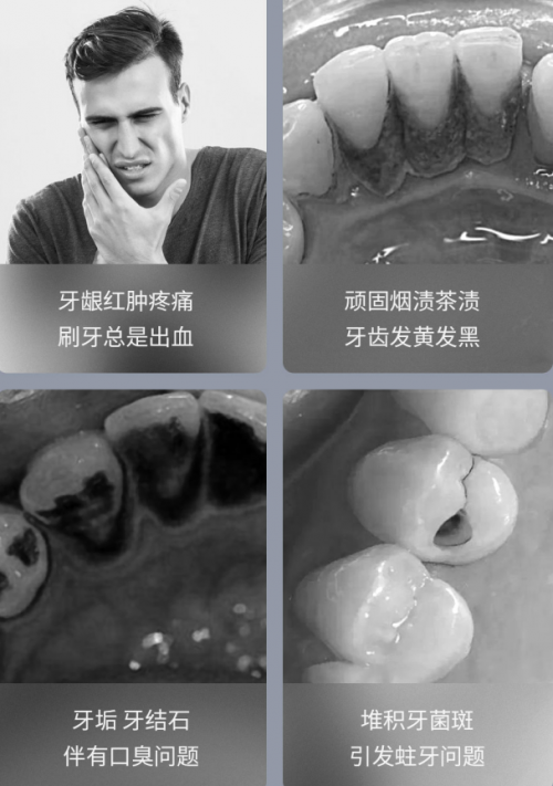周四10點(diǎn)！素諾智能可視沖牙器C3 pro小米有品眾籌明天見！