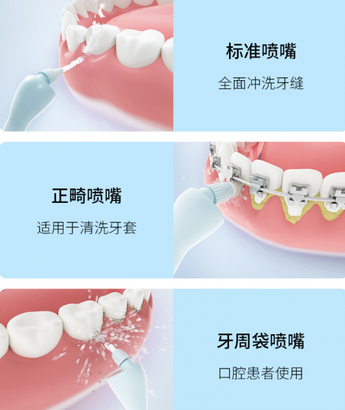 正畸人士福音！素諾智能可視沖牙器C3 pro看得清，沖得凈