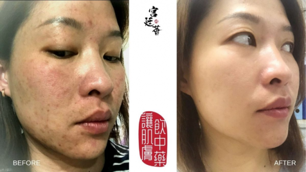 Myeong香港宮廷薈，帶你解鎖宮廷中藥新護(hù)膚方式！