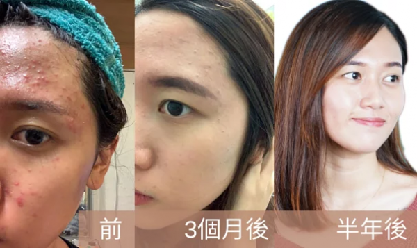 Myeong香港宮廷薈，帶你解鎖宮廷中藥新護(hù)膚方式！