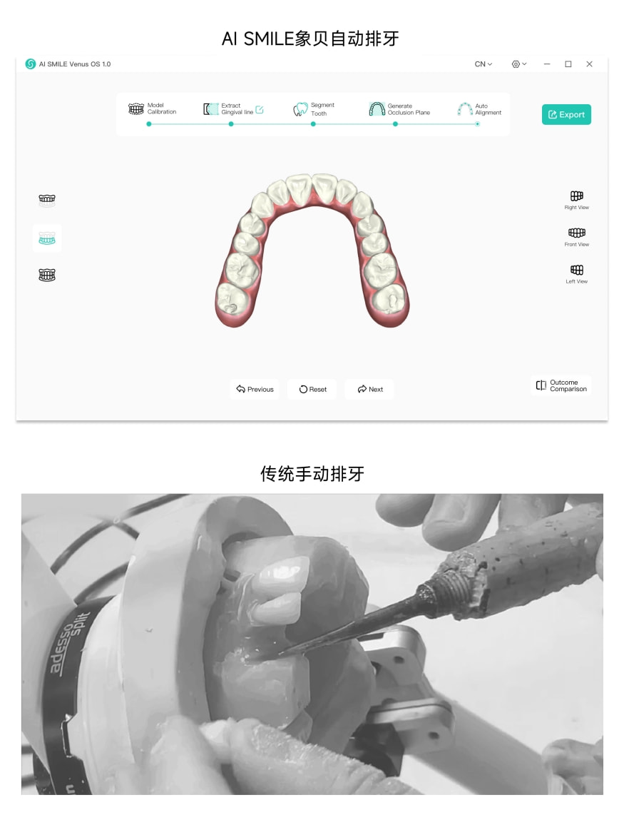 獨(dú)角獸地位盡顯！象貝AI正畸排牙系統(tǒng)Venus1.0發(fā)布 開(kāi)辟數(shù)字化牙科新紀(jì)元