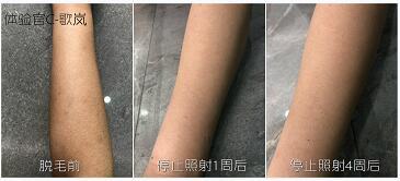 這3款網(wǎng)紅脫毛儀評(píng)測(cè)大集錦，你都了解過(guò)了嗎？