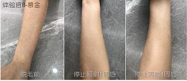 這3款網(wǎng)紅脫毛儀評(píng)測(cè)大集錦，你都了解過(guò)了嗎？