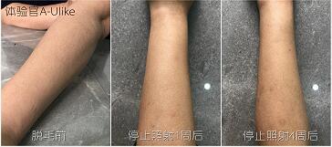 這3款網(wǎng)紅脫毛儀評(píng)測(cè)大集錦，你都了解過(guò)了嗎？