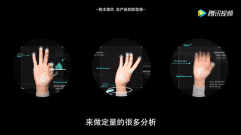 世界帕金森病日：騰訊AI有望成為300萬(wàn)患者的移動(dòng)專屬“醫(yī)生”