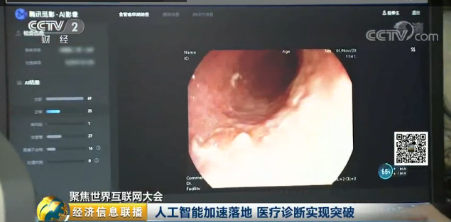 用AI做食管癌診斷證明“科技向善”，騰訊這個腦回路有點神！