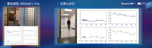 騰訊醫(yī)療人工智能研究院院長(zhǎng)范偉：超越認(rèn)知，AI重塑運(yùn)動(dòng)評(píng)估