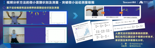 騰訊醫(yī)療人工智能研究院院長(zhǎng)范偉：超越認(rèn)知，AI重塑運(yùn)動(dòng)評(píng)估