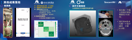 騰訊醫(yī)療人工智能研究院院長(zhǎng)范偉：超越認(rèn)知，AI重塑運(yùn)動(dòng)評(píng)估