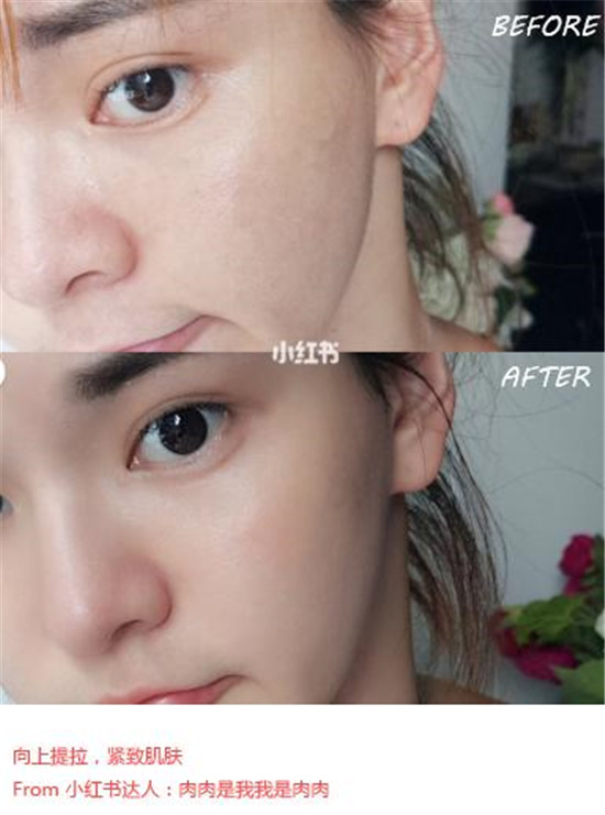 美容儀哪個品牌好？抗老神器歌嵐美容儀了解下