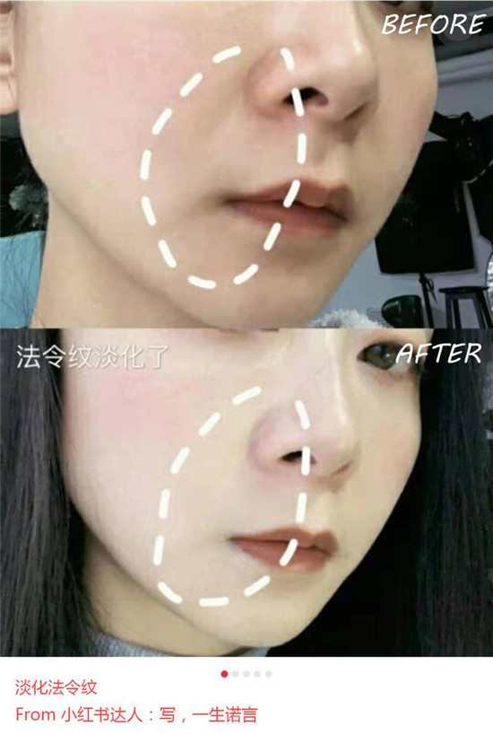 美容儀哪個品牌好？抗老神器歌嵐美容儀了解下