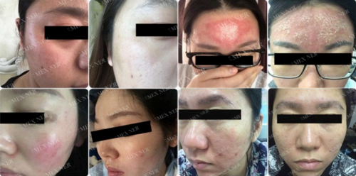 美內(nèi)“小奶泡”，最簡單的潔面產(chǎn)品你選對了嗎？