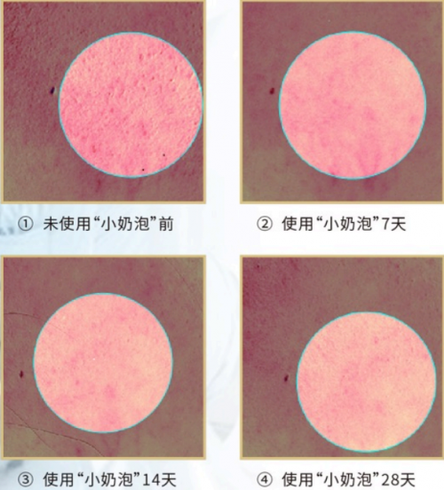 美內(nèi)“小奶泡”，最簡單的潔面產(chǎn)品你選對了嗎？
