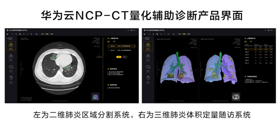 華為云推出新冠肺炎AI輔助診斷服務(wù)，疫情期間免費(fèi)對(duì)定點(diǎn)收治醫(yī)院開放