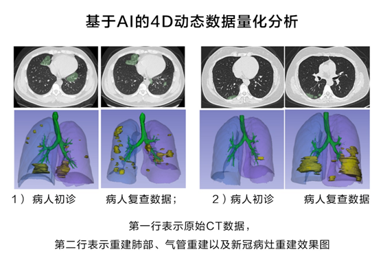 華為云推出新冠肺炎AI輔助診斷服務(wù)，疫情期間免費(fèi)對(duì)定點(diǎn)收治醫(yī)院開放